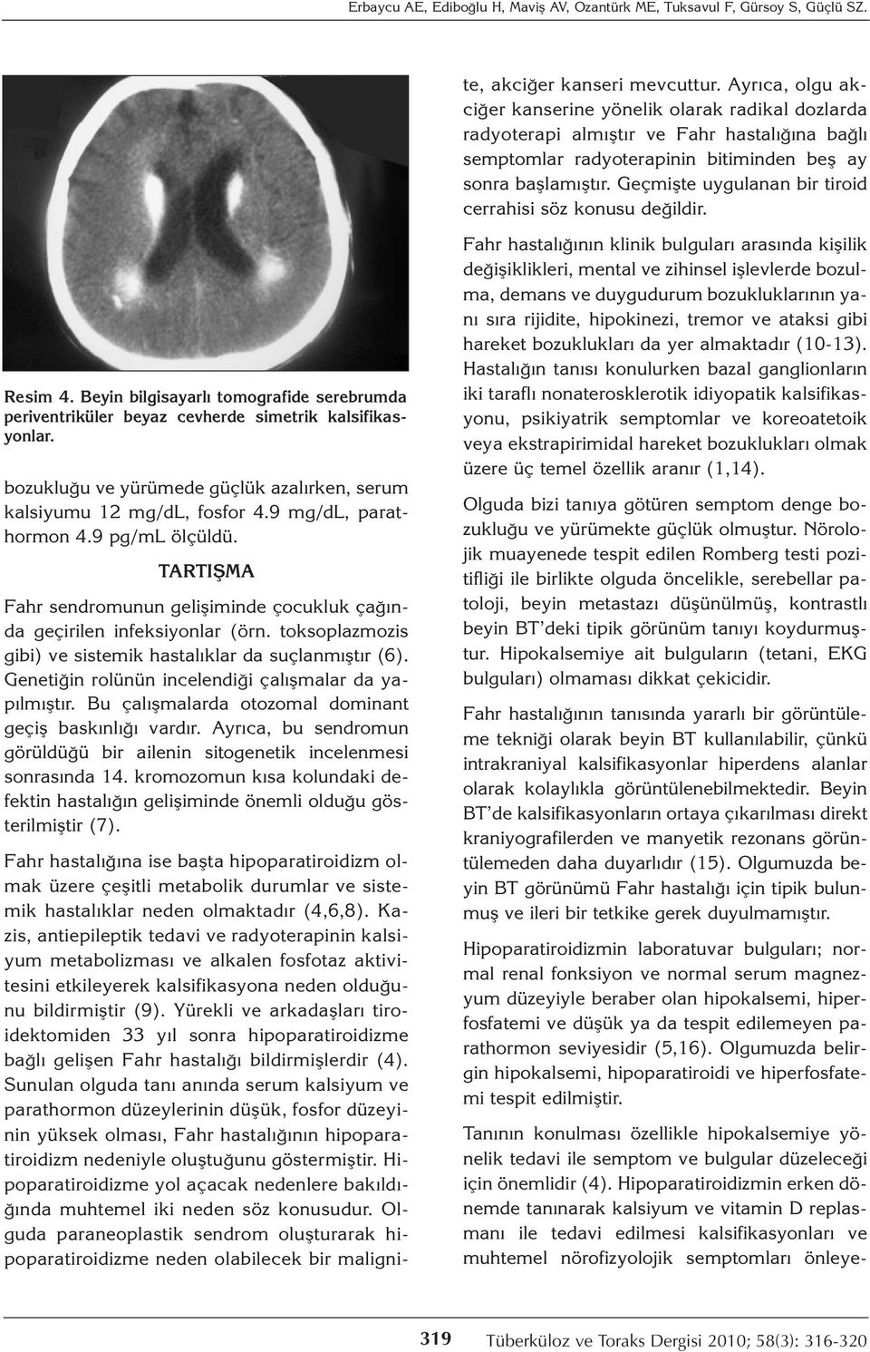 Kazis, antiepileptik tedavi ve radyoterapinin kalsiyum metabolizması ve alkalen fosfotaz aktivitesini etkileyerek kalsifikasyona neden olduğunu bildirmiştir (9).