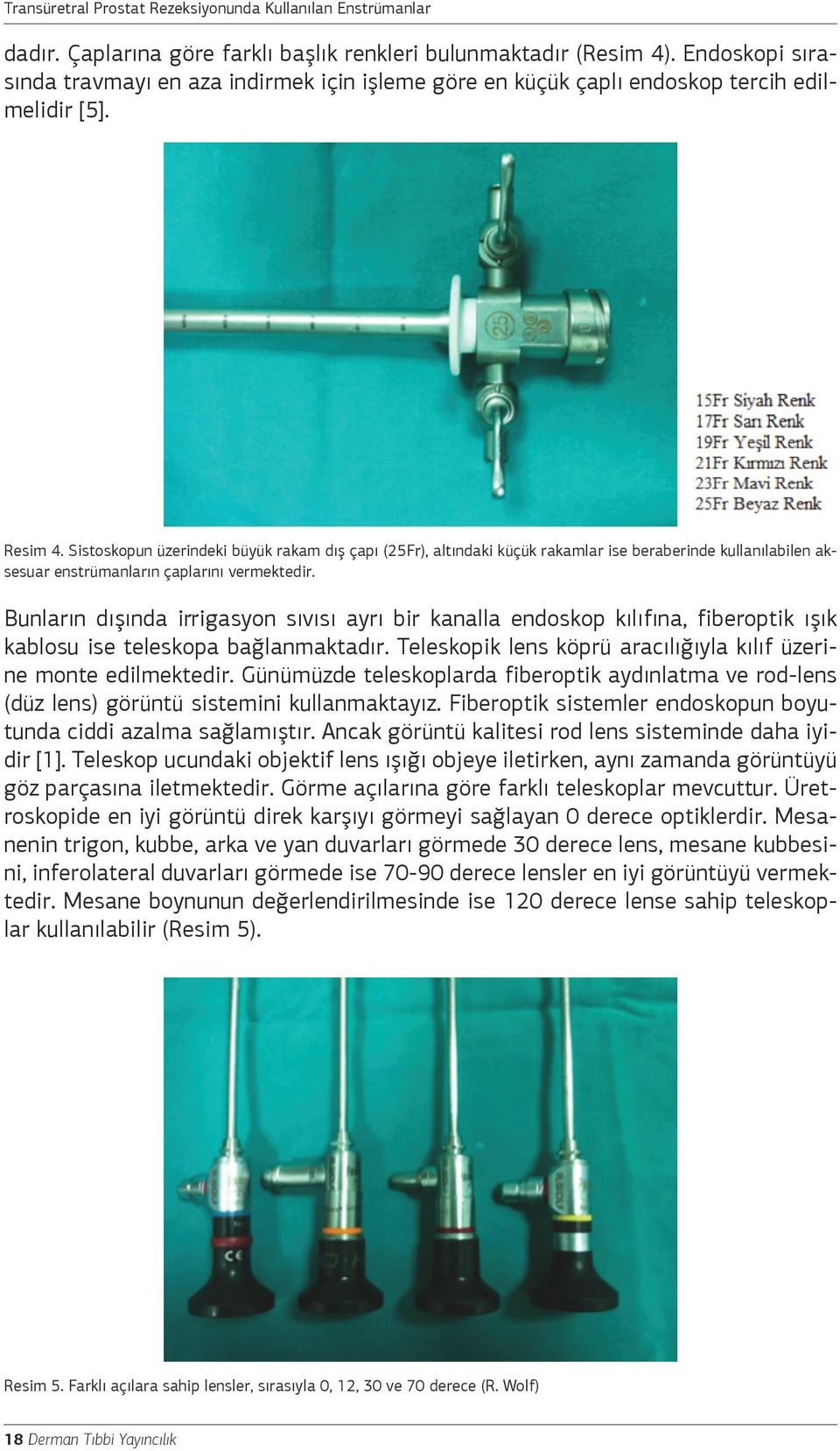 Sistoskopun üzerindeki büyük rakam dış çapı (25Fr), altındaki küçük rakamlar ise beraberinde kullanılabilen aksesuar enstrümanların çaplarını vermektedir.