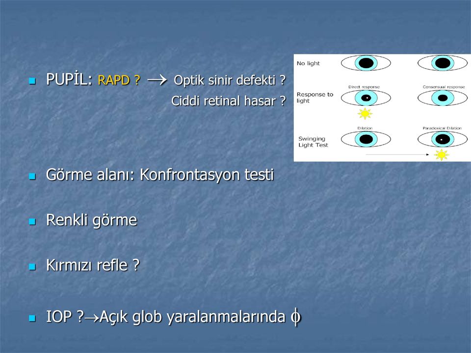 Görme alanı: Konfrontasyon testi