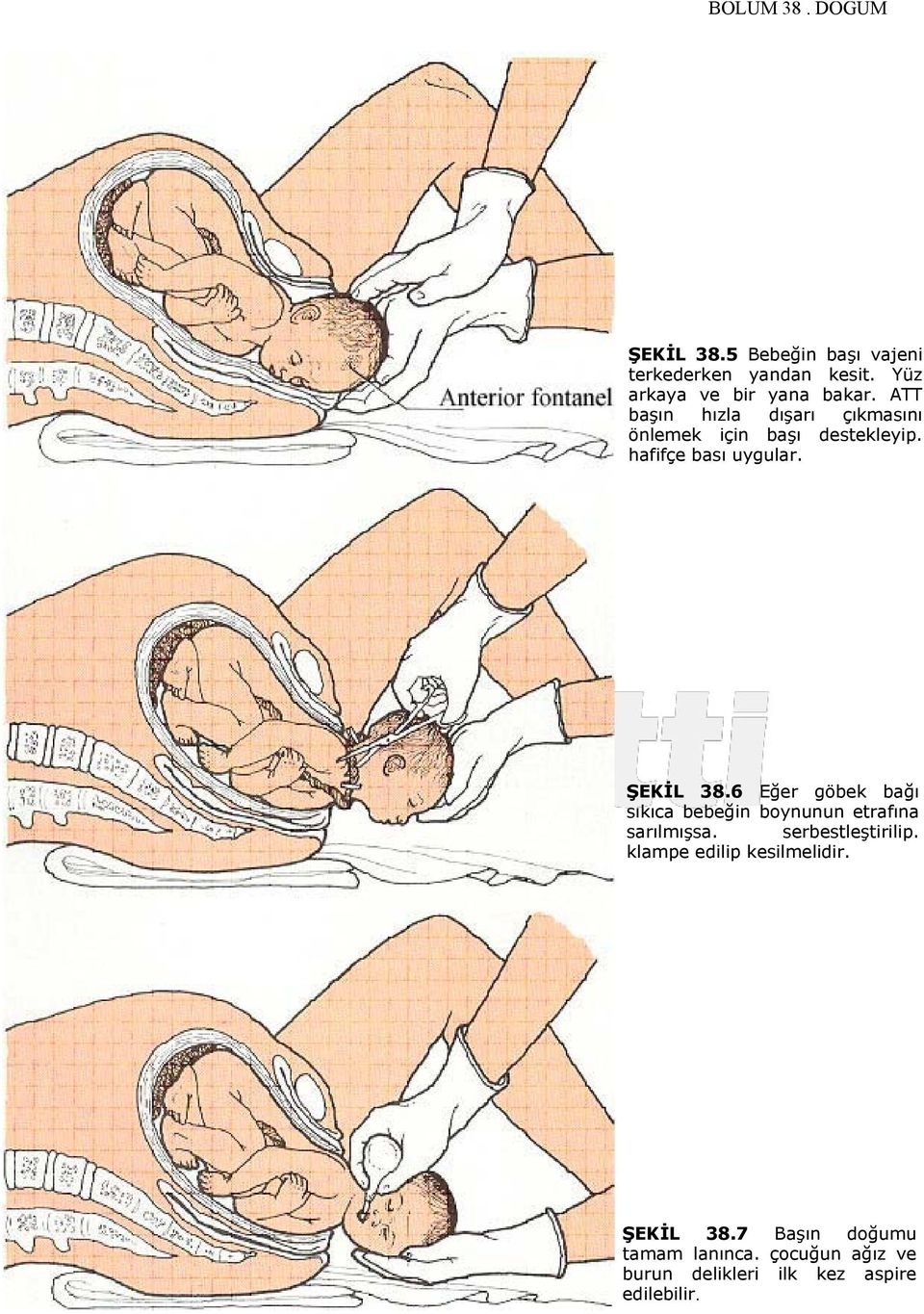 6 Eğer göbek bağı sıkıca bebeğin boynunun etrafına sarılmışsa. serbestleştirilip.