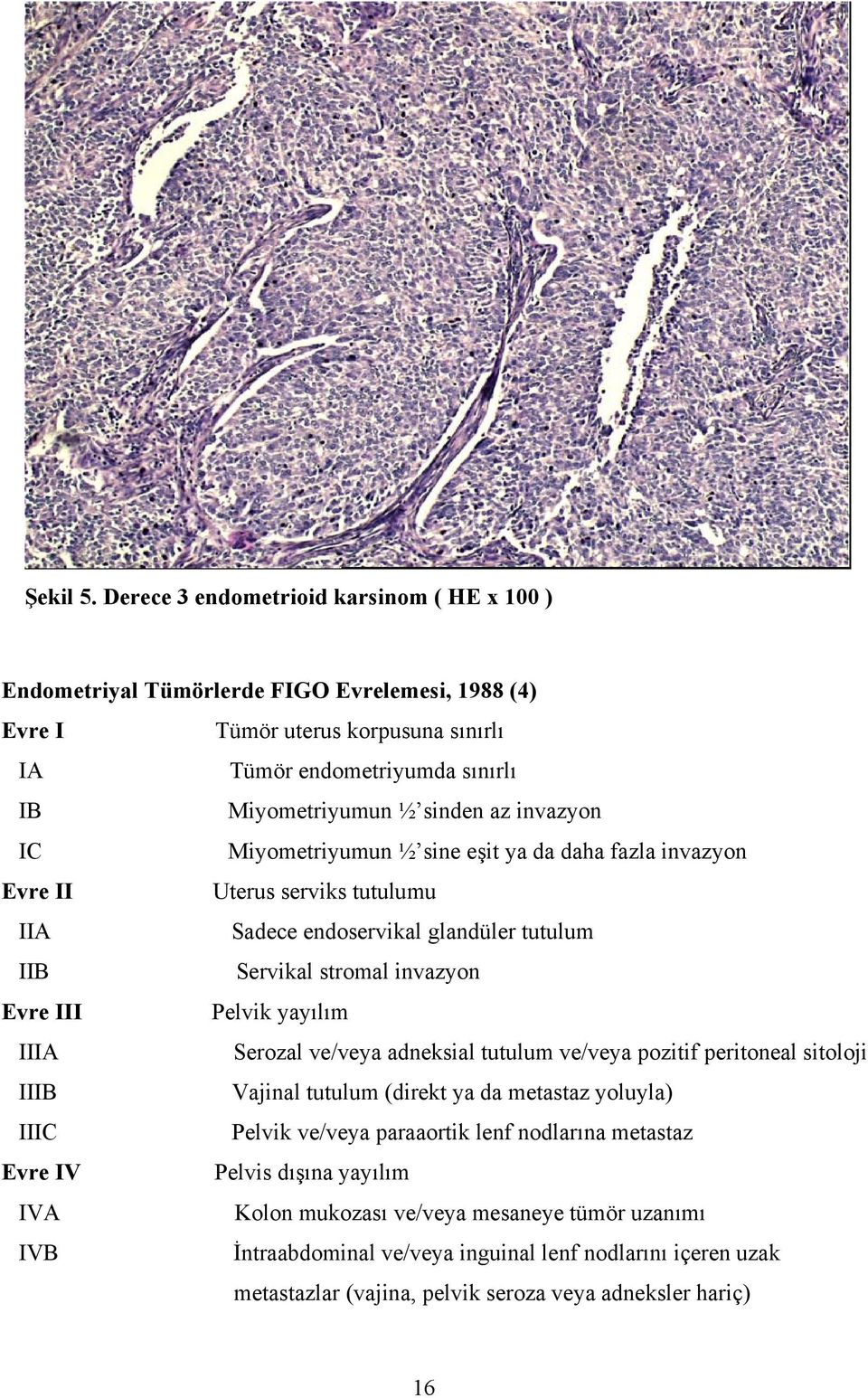 invazyon IC Miyometriyumun ½ sine eşit ya da daha fazla invazyon Evre II Uterus serviks tutulumu IIA Sadece endoservikal glandüler tutulum IIB Servikal stromal invazyon Evre III Pelvik yayılım