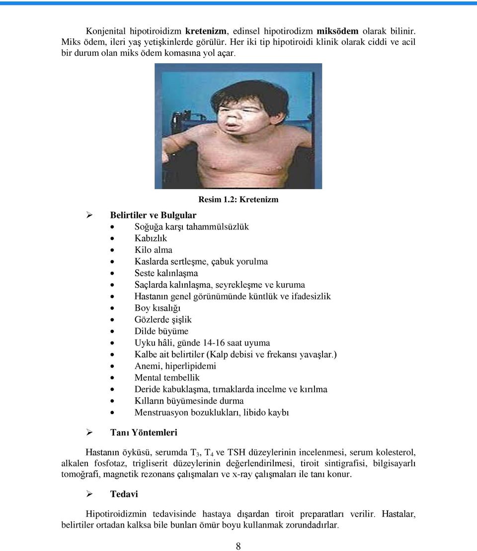 2: Kretenizm Belirtiler ve Bulgular Soğuğa karģı tahammülsüzlük Kabızlık Kilo alma Kaslarda sertleģme, çabuk yorulma Seste kalınlaģma Saçlarda kalınlaģma, seyrekleģme ve kuruma Hastanın genel