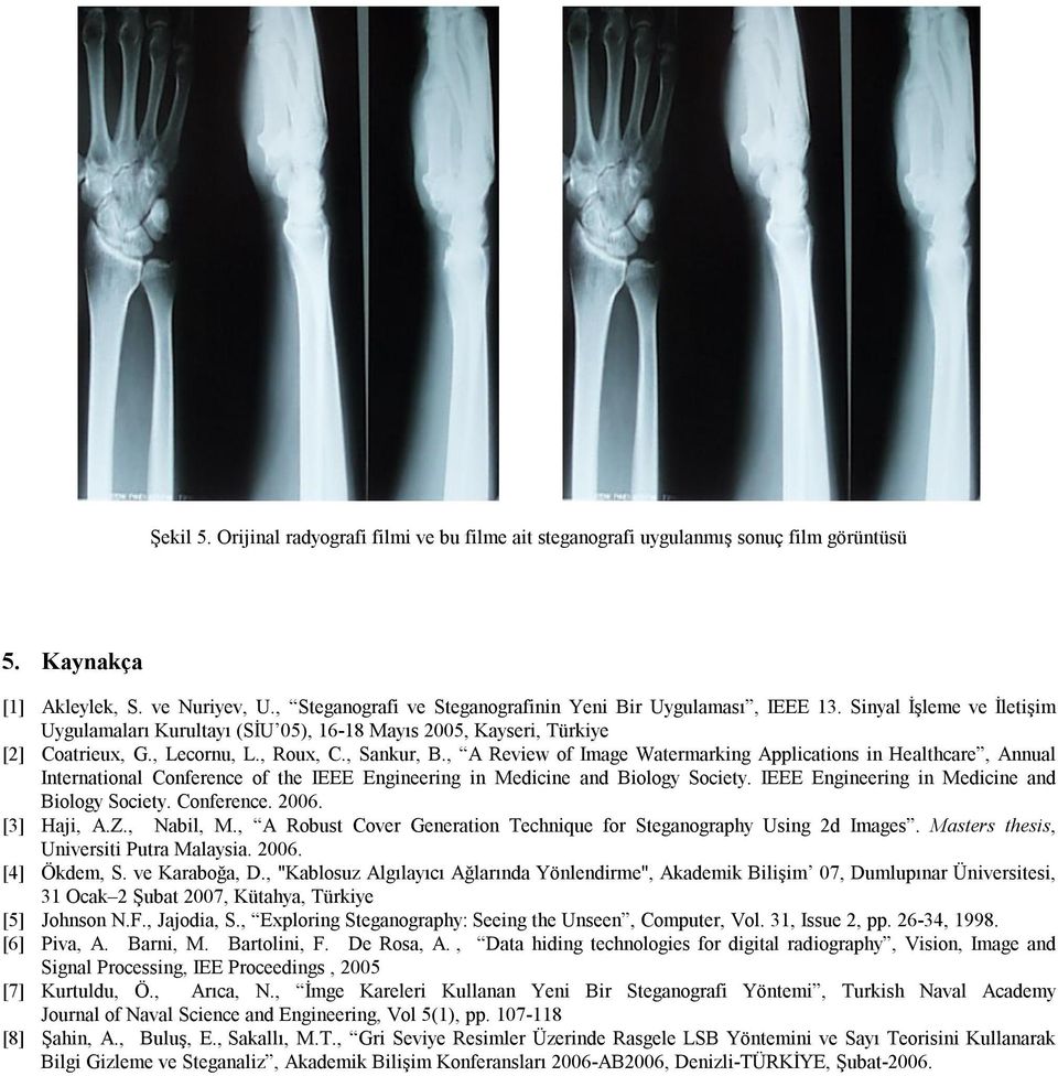 , Sankur, B., A Review of Image Watermarking Applications in Healthcare, Annual International Conference of the IEEE Engineering in Medicine and Biology Society.