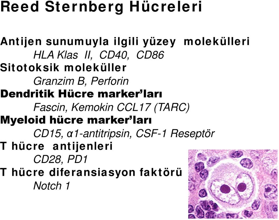 Fascin, Kemokin CCL17 (TARC) Myeloid hücre marker ları CD15, α1-antitripsin,