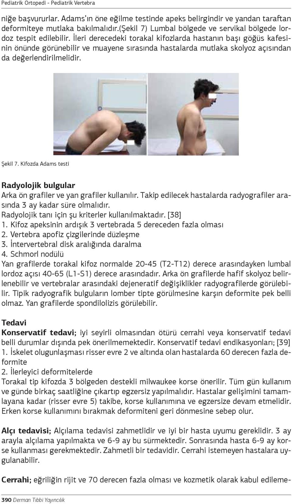 Kifozda Adams testi Radyolojik bulgular Arka ön grafiler ve yan grafiler kullanılır. Takip edilecek hastalarda radyografiler arasında 3 ay kadar süre olmalıdır.