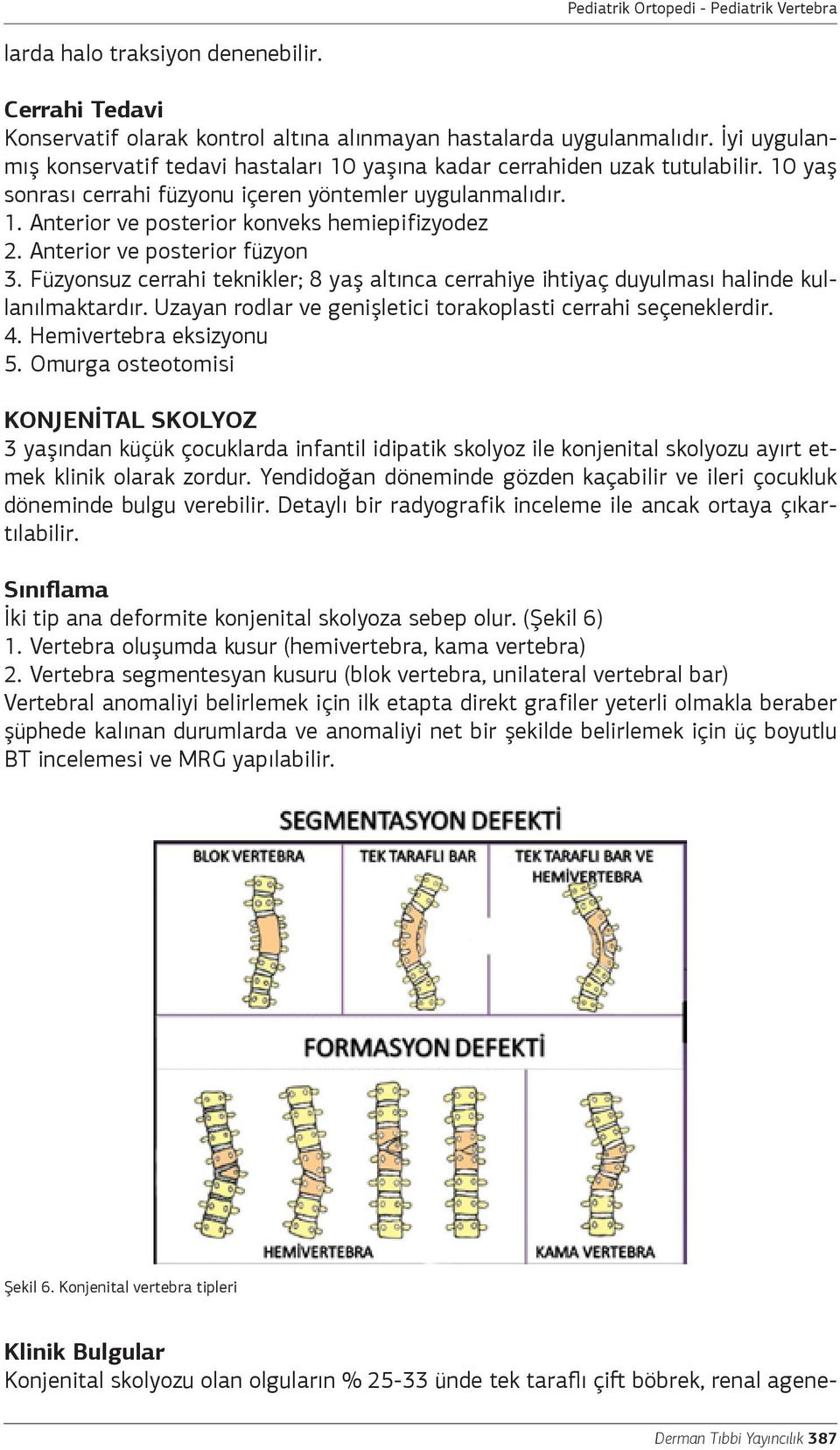 Anterior ve posterior füzyon 3. Füzyonsuz cerrahi teknikler; 8 yaş altınca cerrahiye ihtiyaç duyulması halinde kullanılmaktardır. Uzayan rodlar ve genişletici torakoplasti cerrahi seçeneklerdir. 4.