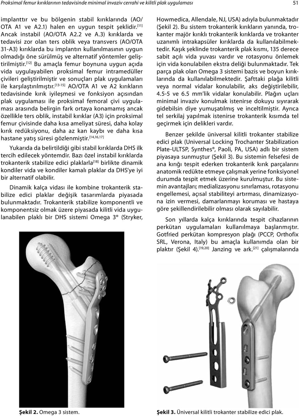 3) kırıklarda ve tedavisi zor olan ters oblik veya transvers (AO/OTA 31-A3) kırıklarda bu implantın kullanılmasının uygun olmadığı öne sürülmüş ve alternatif yöntemler geliştirilmiştir.