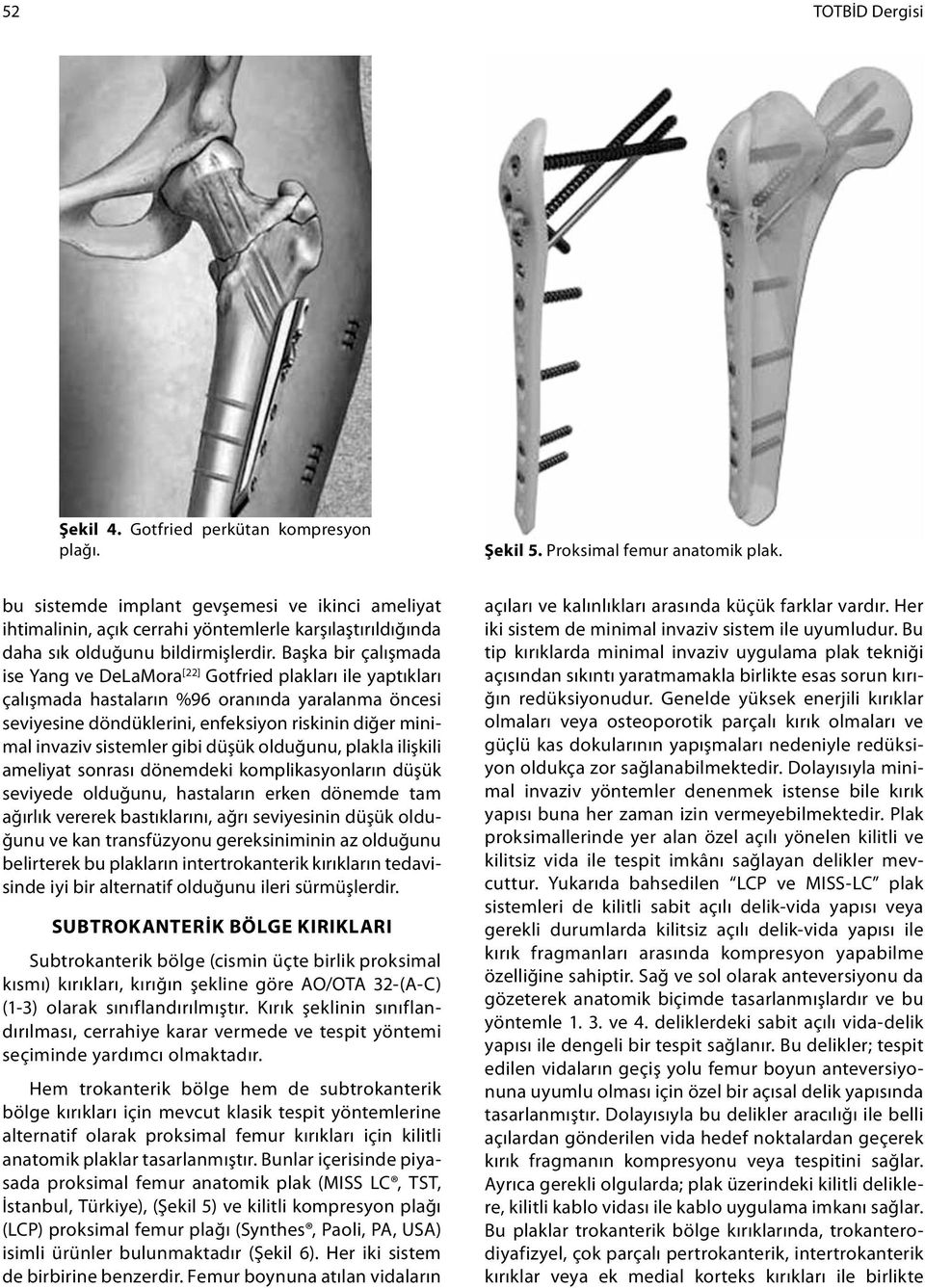 Başka bir çalışmada ise Yang ve DeLaMora [22] Gotfried plakları ile yaptıkları çalışmada hastaların %96 oranında yaralanma öncesi seviyesine döndüklerini, enfeksiyon riskinin diğer minimal invaziv