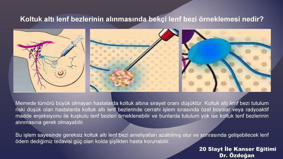 enjeksiyonu ile kuşkulu lenf bezleri örneklenebilir ve bunlarda tutulum yok ise koltuk lenf bezlerinin alınmasına gerek olmayabilir.