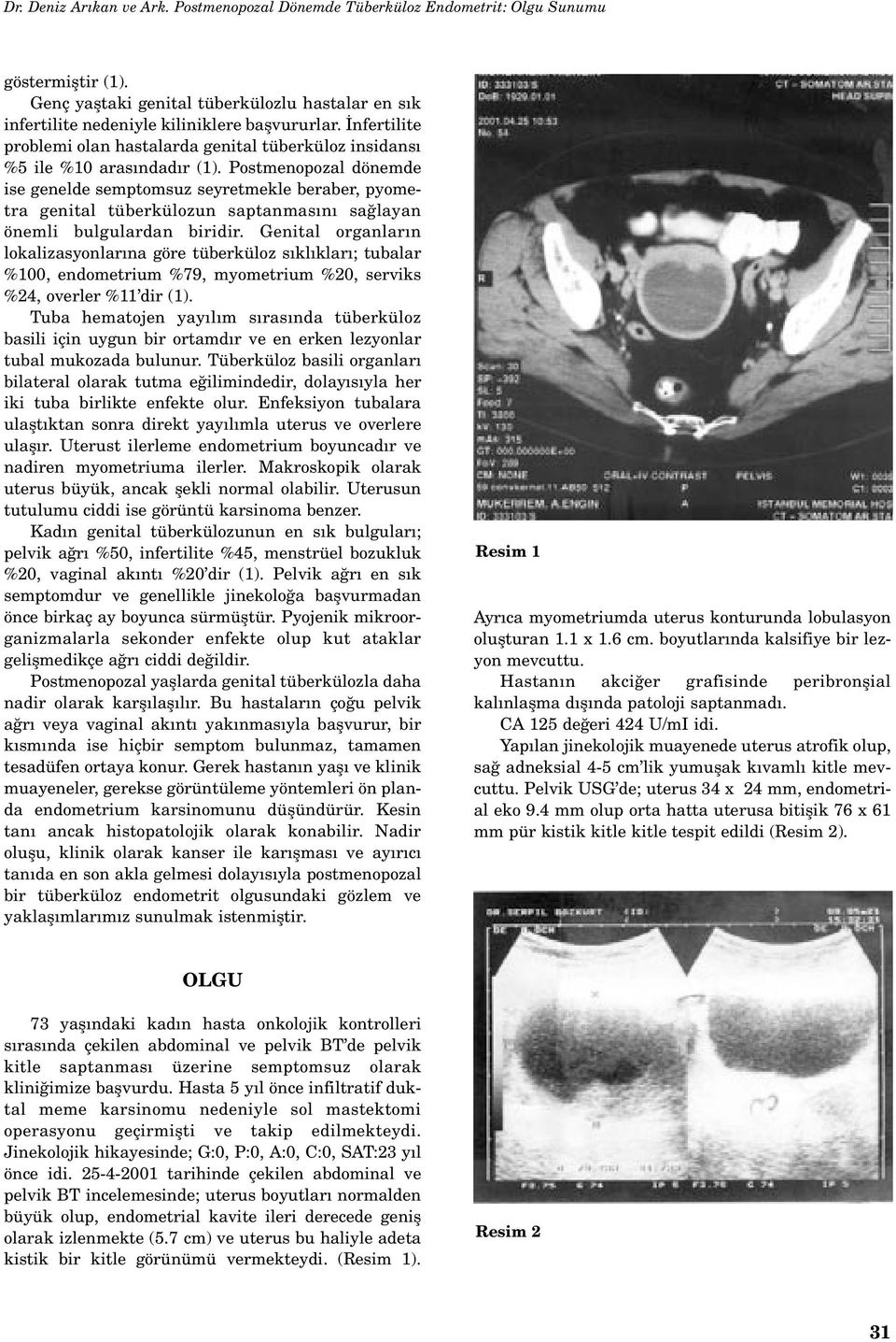 Postmenopozal dönemde ise genelde semptomsuz seyretmekle beraber, pyometra genital tüberkülozun saptanmas n sa layan önemli bulgulardan biridir.