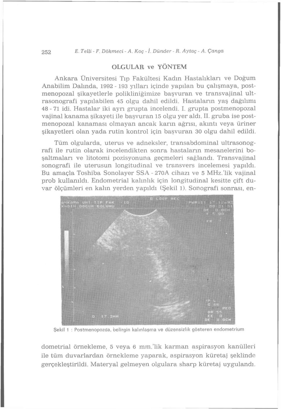 ve transvajinal ultrasonografi yapılabilen 45 olgu dahil edildi. Hastaların yaş dağılımı 48-7 idi. Hastalar iki ayrı grupta incelendi. I.