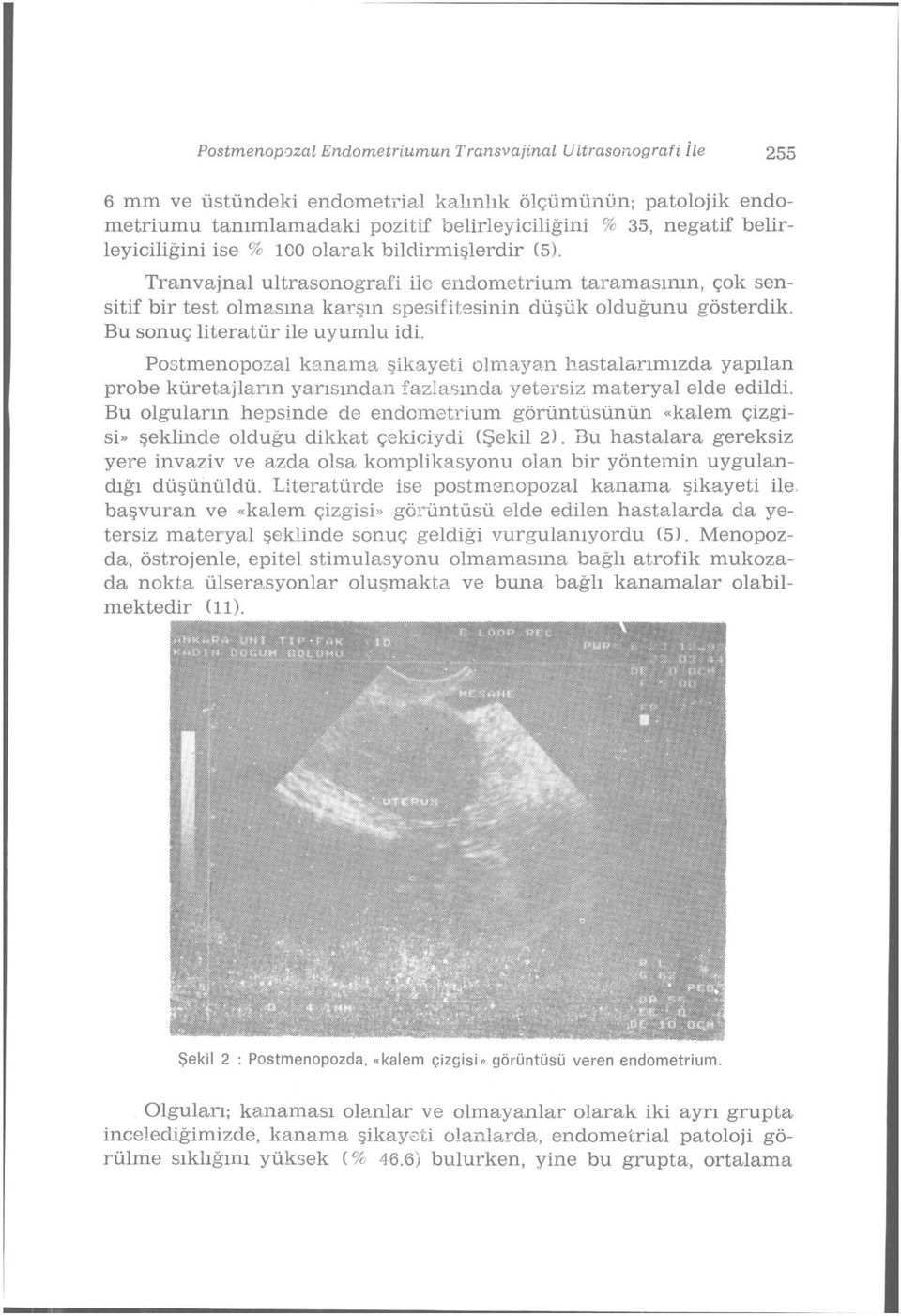 Bu sonuç literatür ile uyumlu idi. Postmenopozal kanama şikayeti olmayan hastalarımızda, yapılan probe küretajların yarısından fazlasında yetersiz materyal elde edildi.