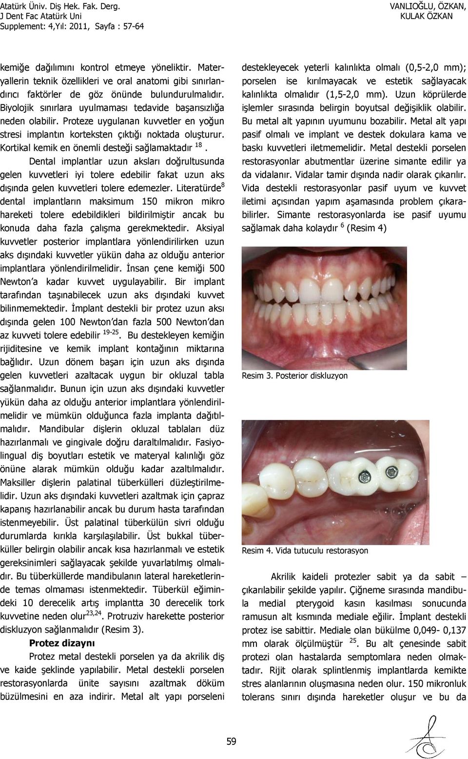 Kortikal kemik en önemli desteği sağlamaktadır 18. Dental implantlar uzun aksları doğrultusunda gelen kuvvetleri iyi tolere edebilir fakat uzun aks dışında gelen kuvvetleri tolere edemezler.