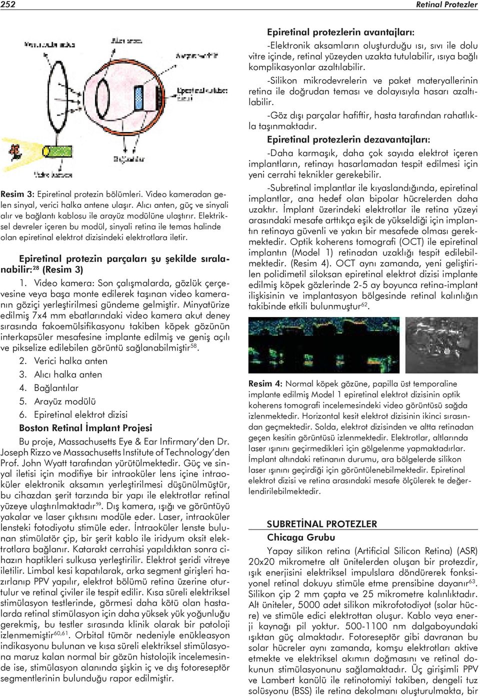 Elektriksel devreler içeren bu modül, sinyali retina ile temas halinde olan epiretinal elektrot dizisindeki elektrotlara iletir. Epiretinal protezin parçaları şu şekilde sıralanabilir: 28 (Resim 3) 1.