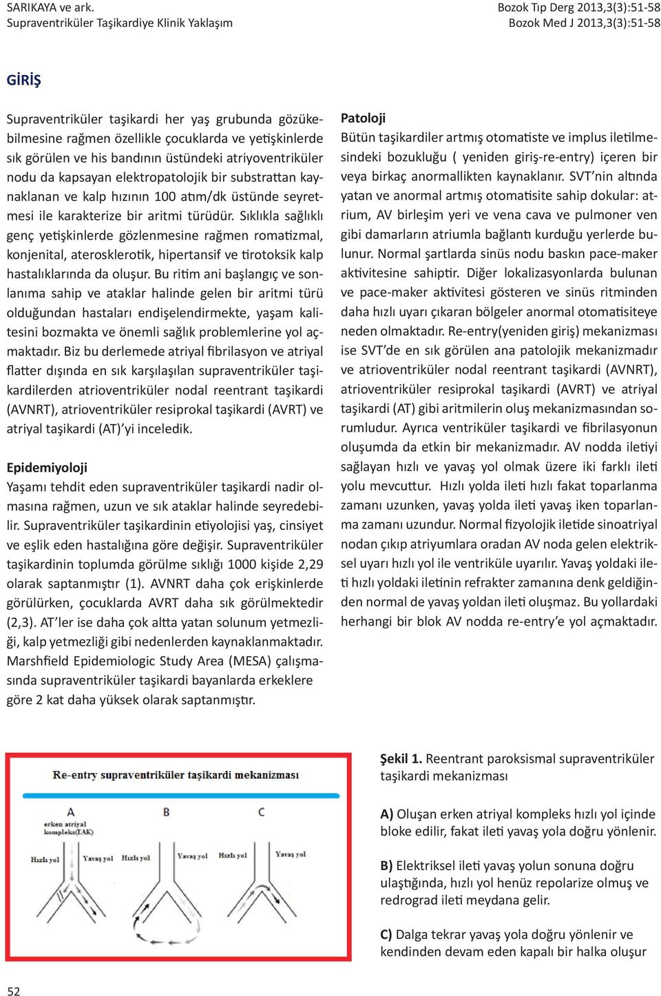 elektropatolojik bir substrattan kaynaklanan ve kalp hızının 100 atım/dk üstünde seyretmesi ile karakterize bir aritmi türüdür.