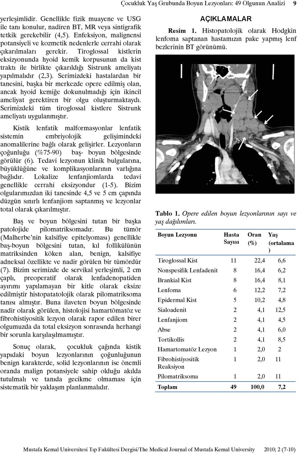 Tiroglossal kistlerin eksizyonunda hyoid kemik korpusunun da kist traktı ile birlikte çıkarıldığı Sistrunk ameliyatı yapılmalıdır (2,3).