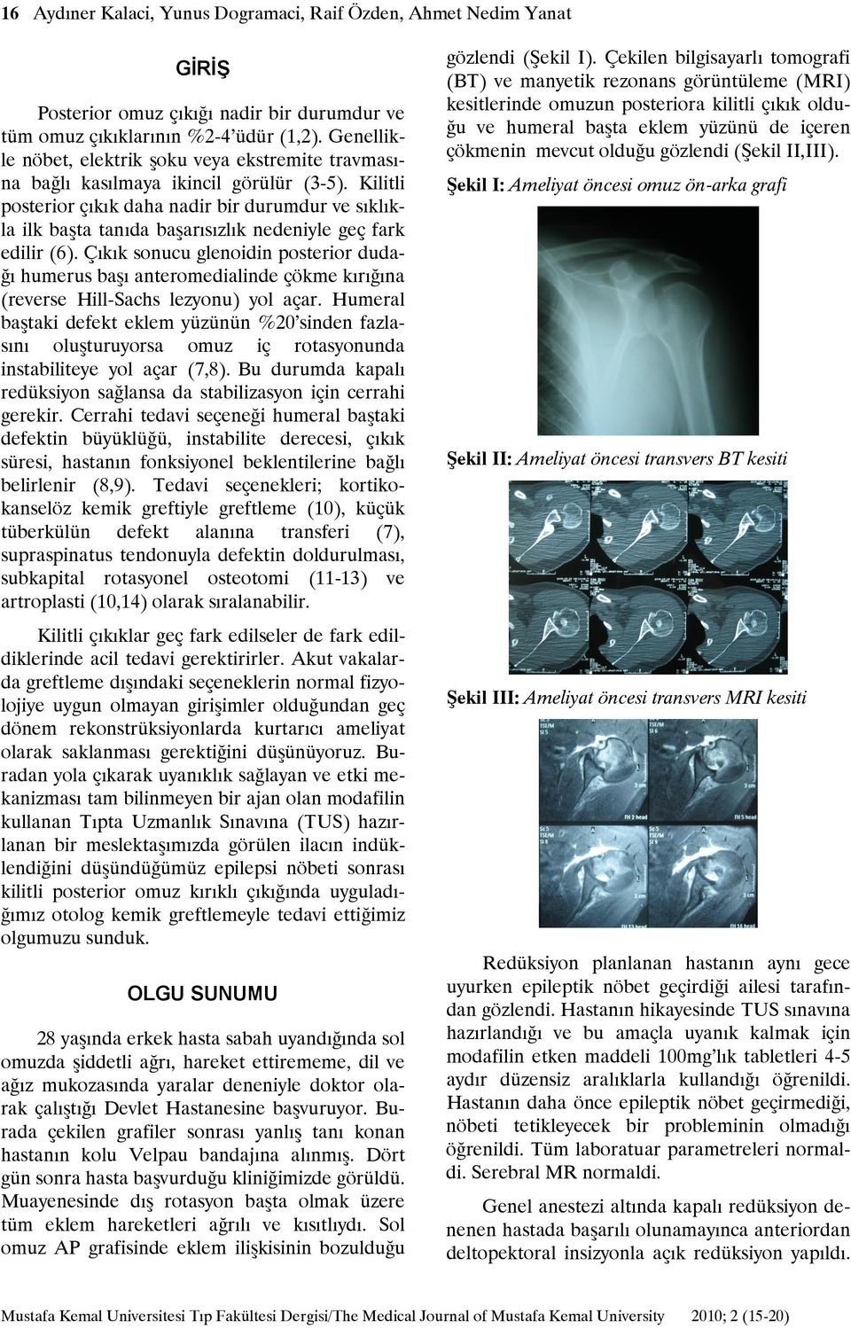 Kilitli posterior çıkık daha nadir bir durumdur ve sıklıkla ilk başta tanıda başarısızlık nedeniyle geç fark edilir (6).