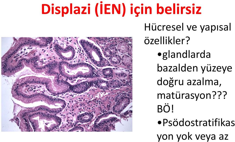 glandlarda bazalden yüzeye doğru