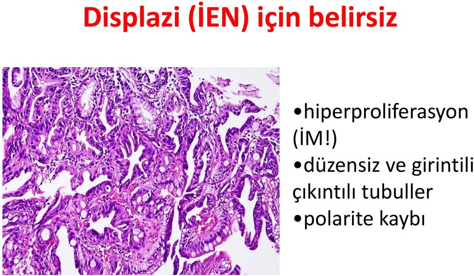 (İM!) düzensiz ve girintili