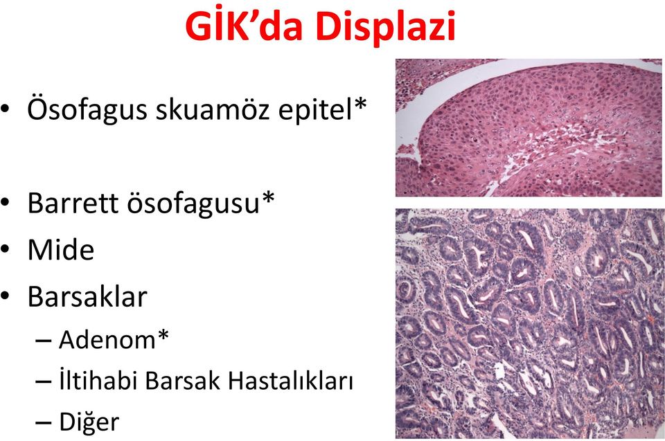 ösofagusu* Mide Barsaklar