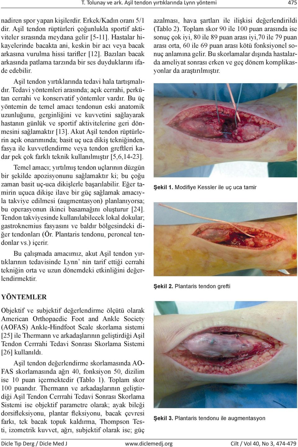 Bazıları bacak arkasında patlama tarzında bir ses duyduklarını ifade edebilir. Aşil tendon yırtıklarında tedavi hala tartışmalıdır.