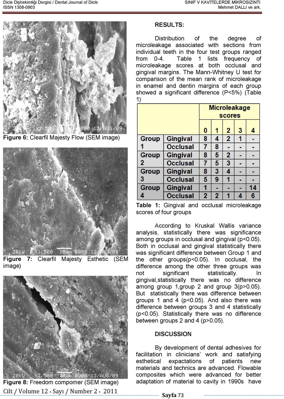 The Mann-Whitney U test for comparison of the mean rank of microleakage in enamel and dentin margins of each group showed a significant difference (P<5%) (Table 1) Figure 6: Clearfil Majesty Flow