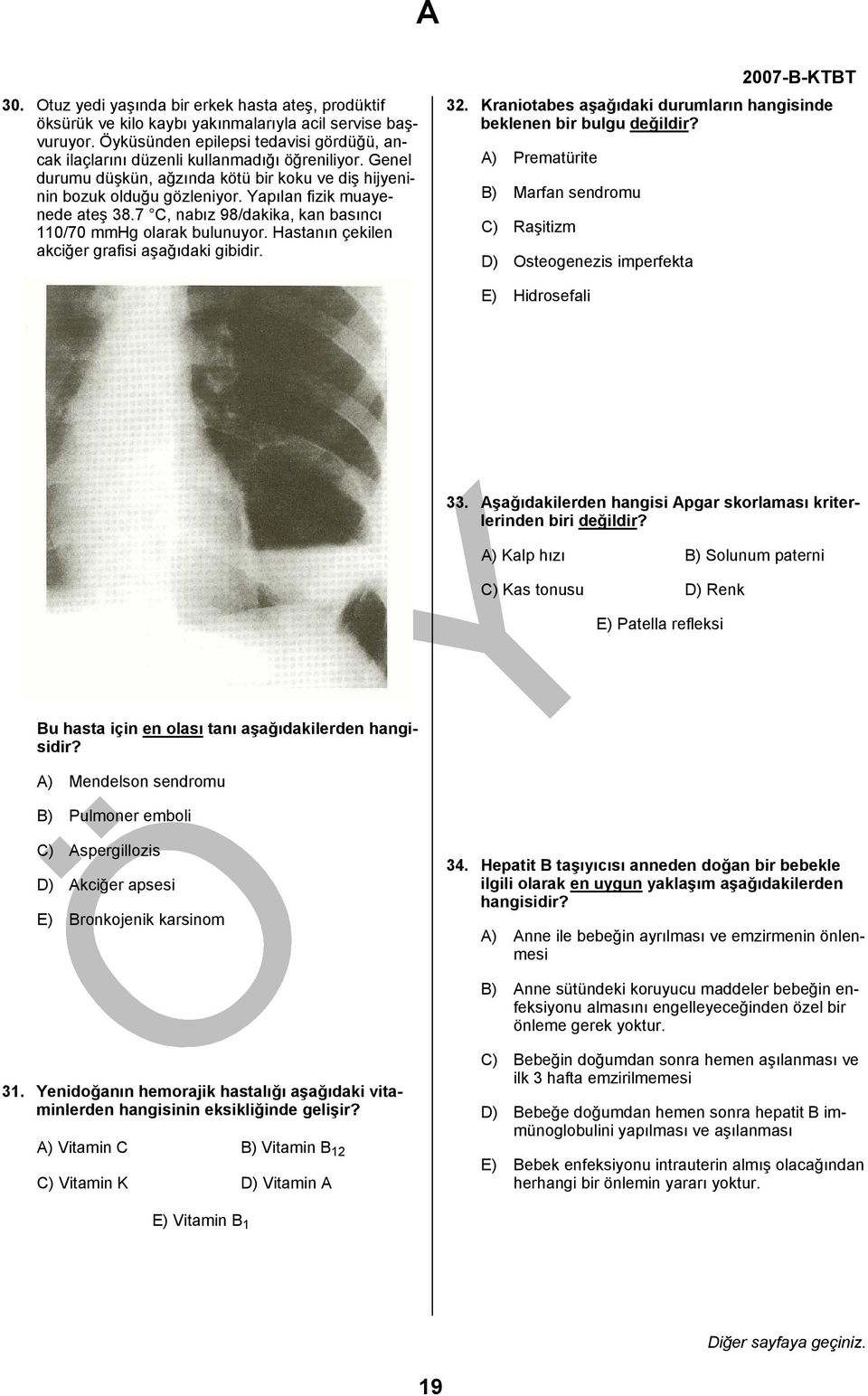 Yapılan fizik muayenede ateş 38.7 C, nabız 98/dakika, kan basıncı 110/70 mmhg olarak bulunuyor. Hastanın çekilen akciğer grafisi aşağıdaki gibidir. 32.