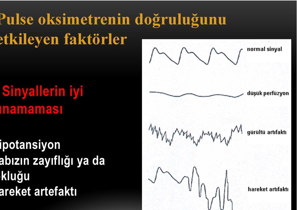 iyi namaması potansiyon bızın