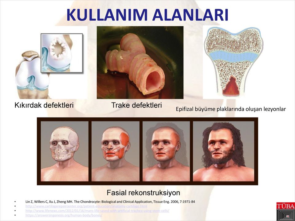 The Chondrocyte: Biological and Clinical Application, Tissue Eng. 2006, 7:1971-84 http://www.