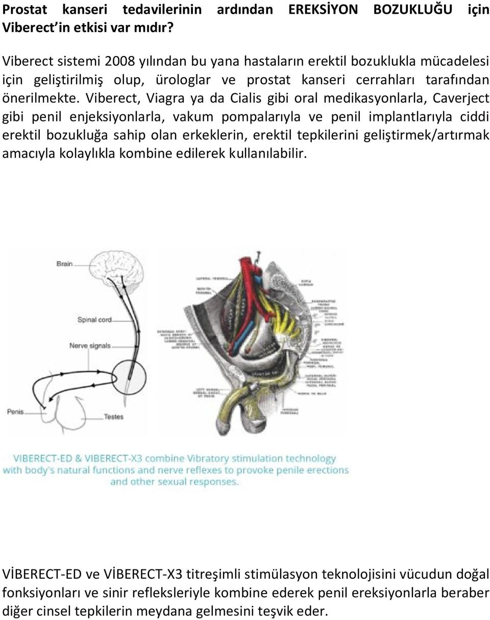 Viberect, Viagra ya da Cialis gibi oral medikasyonlarla, Caverject gibi penil enjeksiyonlarla, vakum pompalarıyla ve penil implantlarıyla ciddi erektil bozukluğa sahip olan erkeklerin,