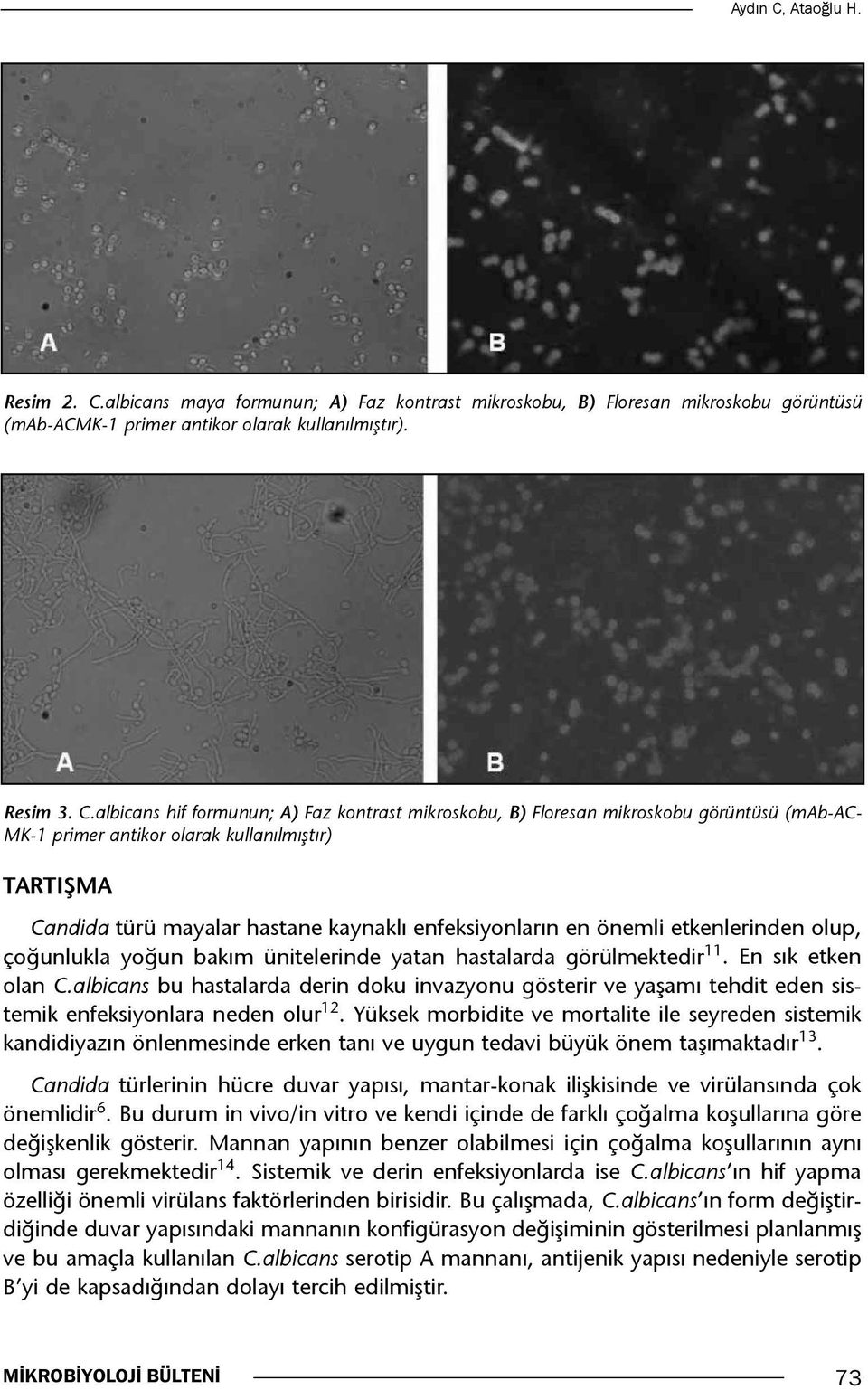 albicans maya formunun; A) Faz kontrast mikroskobu, B) Floresan mikroskobu görüntüsü (mab-acmk-1 primer antikor olarak kullanılmıştır). Resim 3. C.