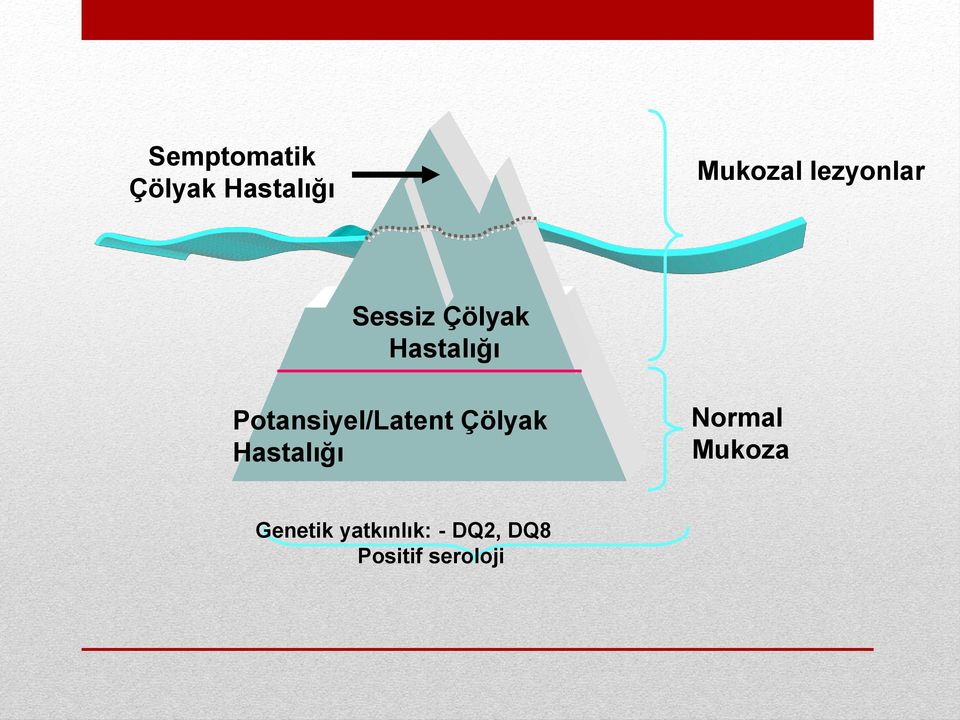 Potansiyel/Latent Çölyak Hastalığı Normal