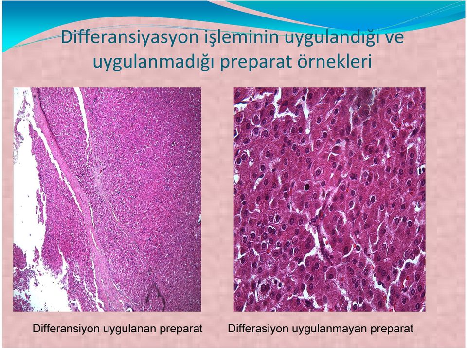 preparat örnekleri Differansiyon