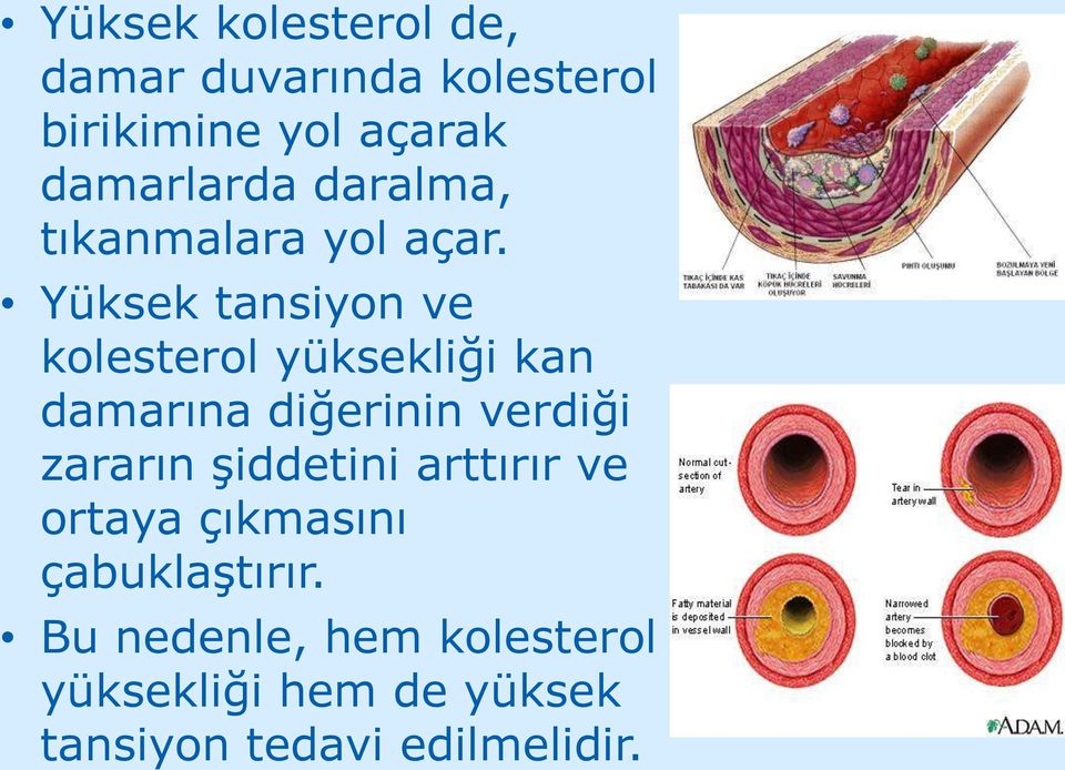 Yüksek tansiyon ve kolesterol yüksekliği kan damarına diğerinin verdiği zararın