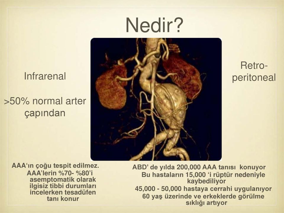 konur ABD de yılda 200,000 AAA tanısı konuyor Bu hastaların 15,000 i rüptür nedeniyle