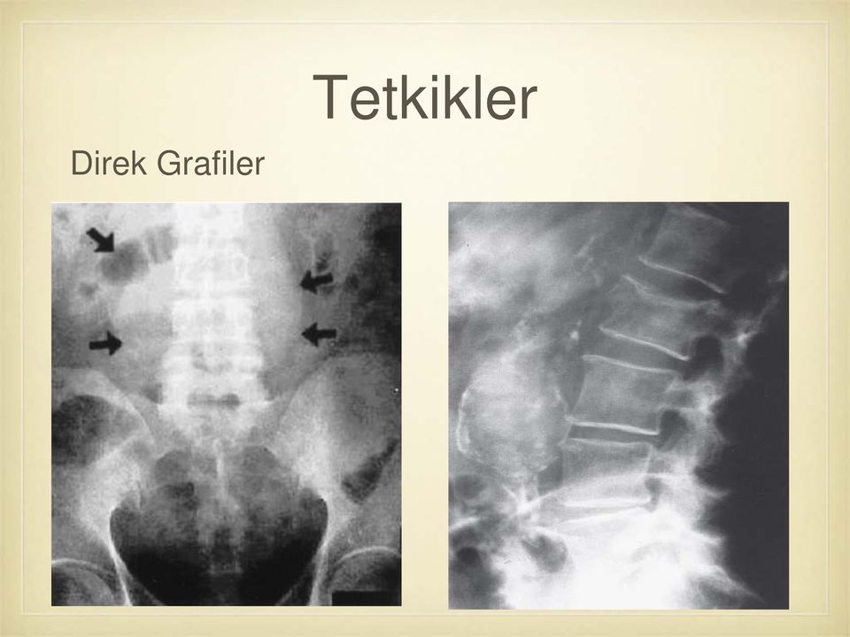 Tetkikler