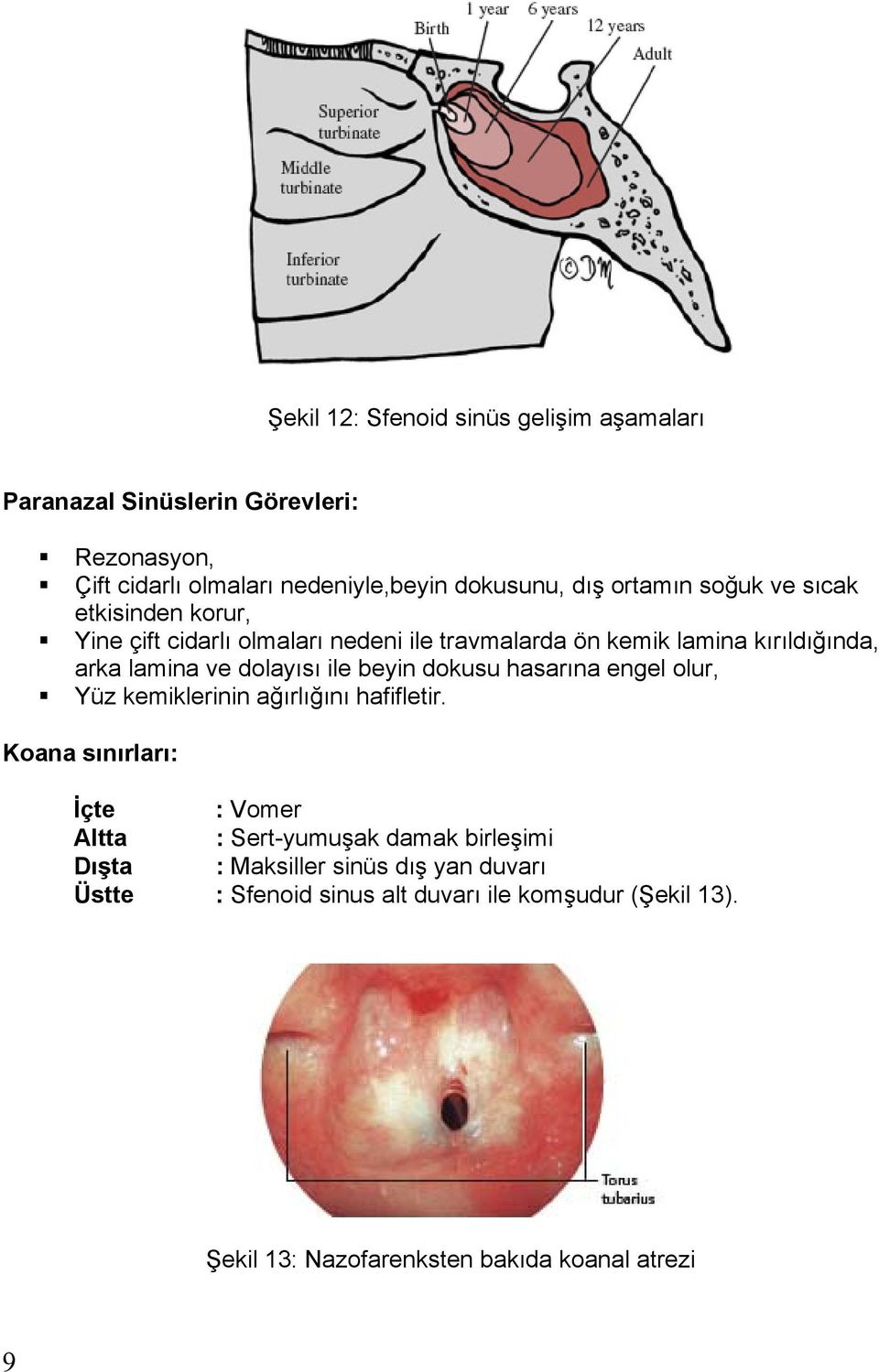 beyin dokusu hasar na engel olur, Yüz kemiklerinin a rl n hafifletir.