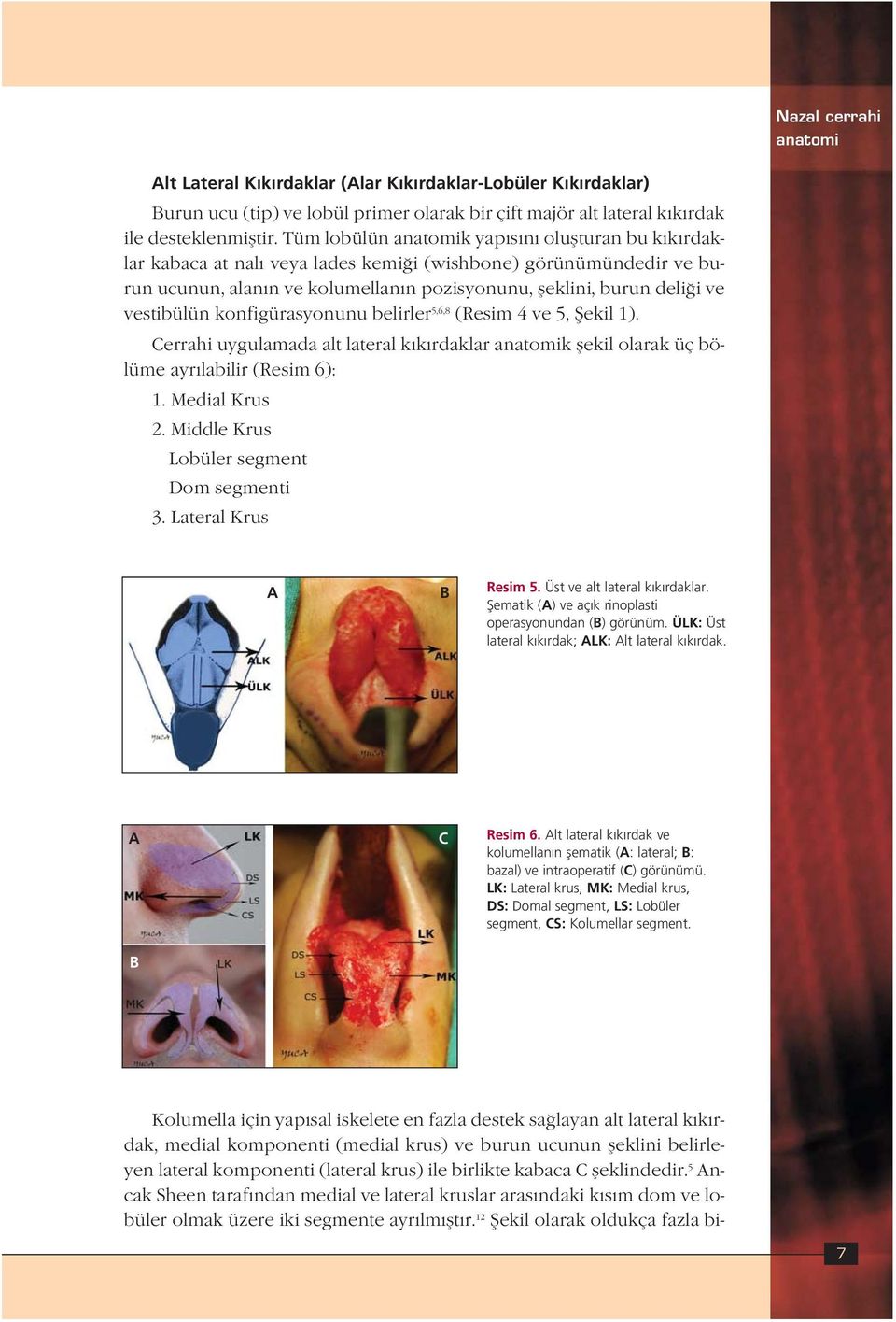 vestibülün konfigürasyonunu belirler 5,6,8 (Resim 4 ve 5, fiekil 1). Cerrahi uygulamada alt lateral k k rdaklar anatomik flekil olarak üç bölüme ayr labilir (Resim 6): 1. Medial Krus 2.