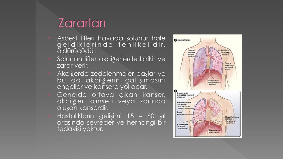 Akciğerde zedelenmeler başlar ve bu da akci ğ erin çalı ş masını engeller ve kansere yol açar.