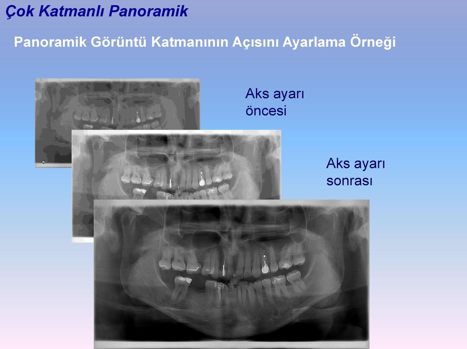 Katmanının Açısını Ayarlama