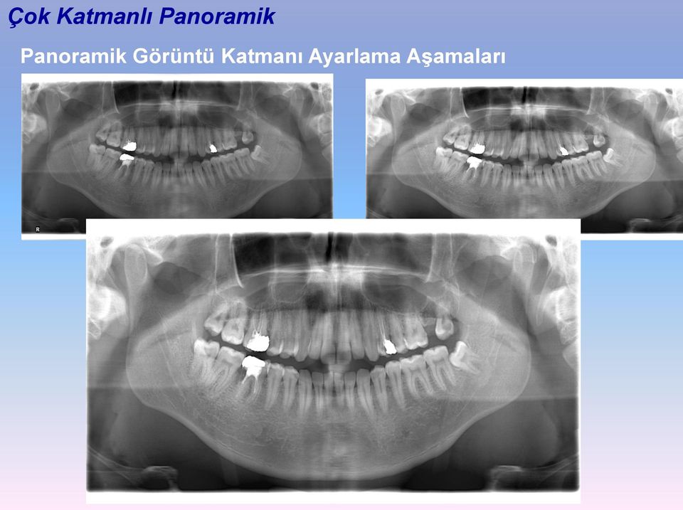 Görüntü Katmanı