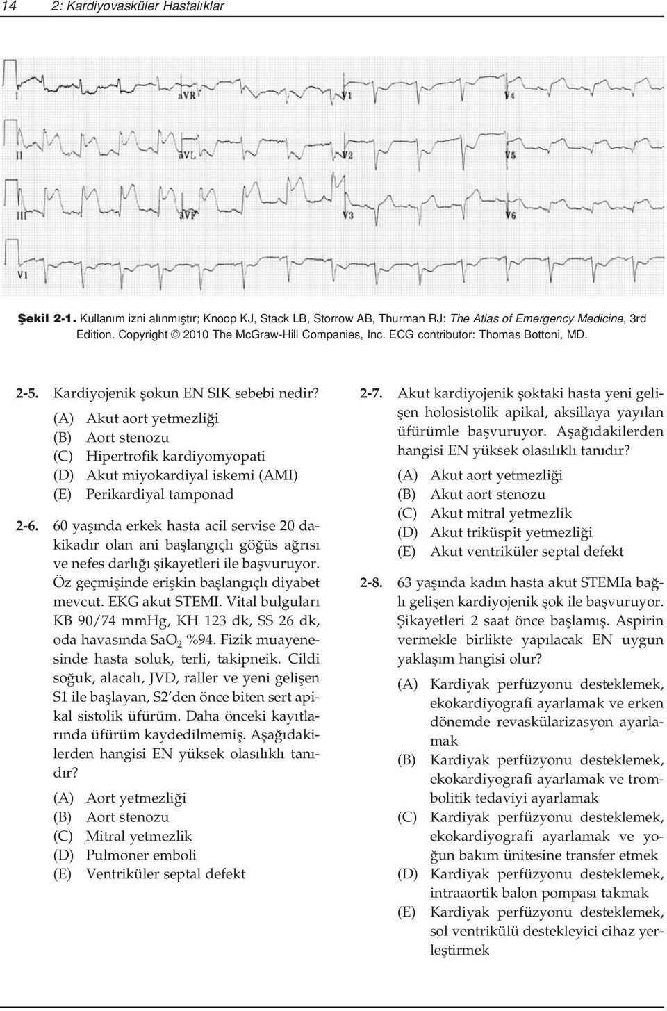(A) Akut aort yetmezli i (B) Aort stenozu (C) Hipertrofik kardiyomyopati (D) Akut miyokardiyal iskemi (AMI) (E) Perikardiyal tamponad 2-6.
