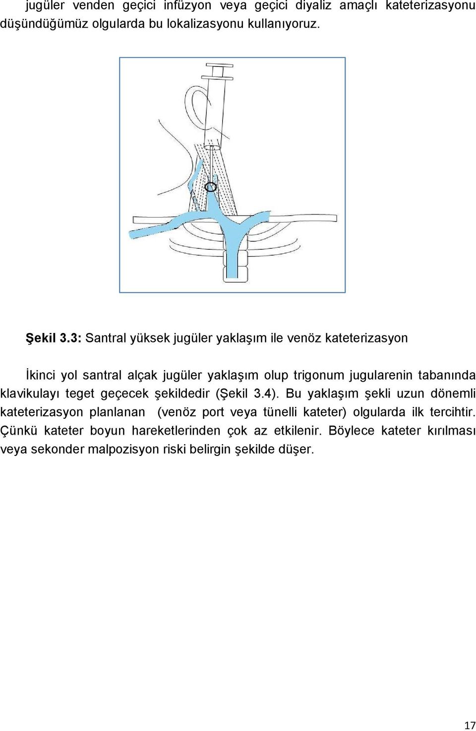 klavikulayı teget geçecek şekildedir (Şekil 3.4).