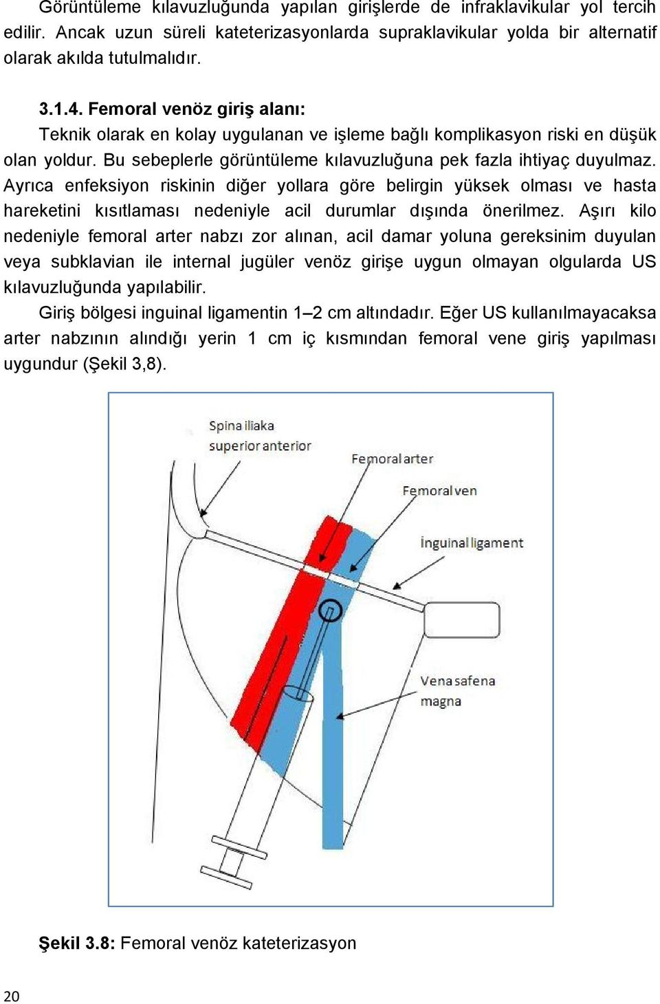 Ayrıca enfeksiyon riskinin diğer yollara göre belirgin yüksek olması ve hasta hareketini kısıtlaması nedeniyle acil durumlar dışında önerilmez.