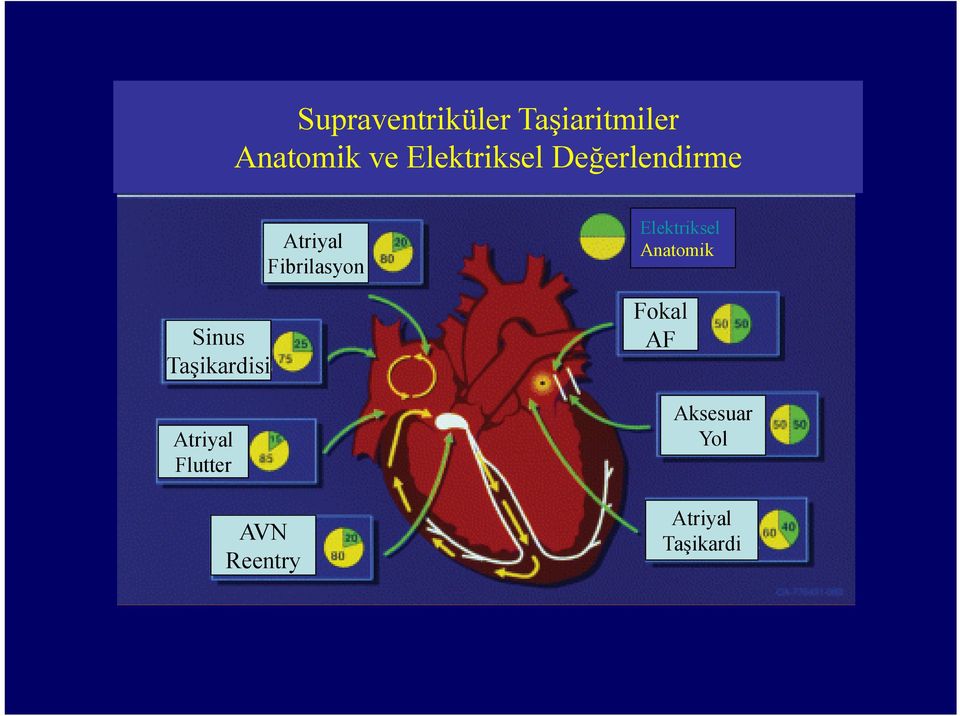 Atriyal Flutter AVN Reentry Atriyal Fibrilasyon