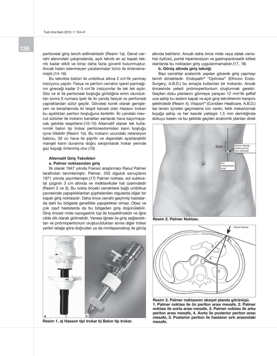 Fasya ve periton cerrahın işaret parmağının gireceği kadar 2-3 cm lik insizyonlar ile tek tek açılır.