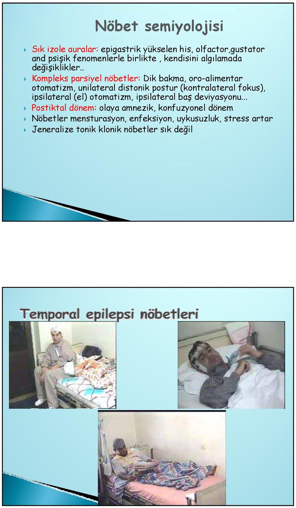 . Kompleks parsiyel nöbetler: Dik bakma, oro-alimentar otomatizm, unilateral distonik postur (kontralateral fokus),