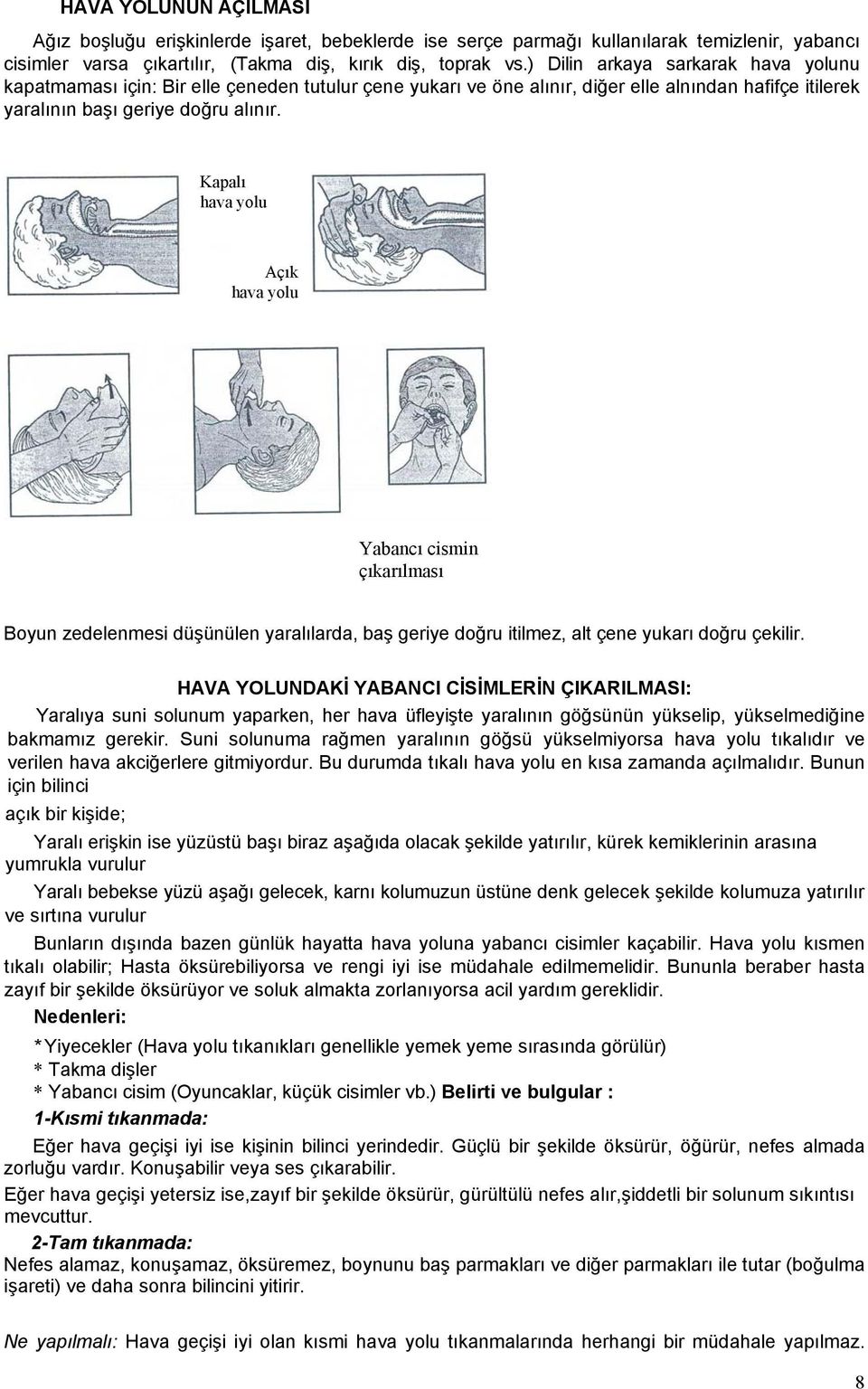 Kapalı hava yolu Açık hava yolu Yabancı cismin çıkarılması Boyun zedelenmesi düşünülen yaralılarda, baş geriye doğru itilmez, alt çene yukarı doğru çekilir.