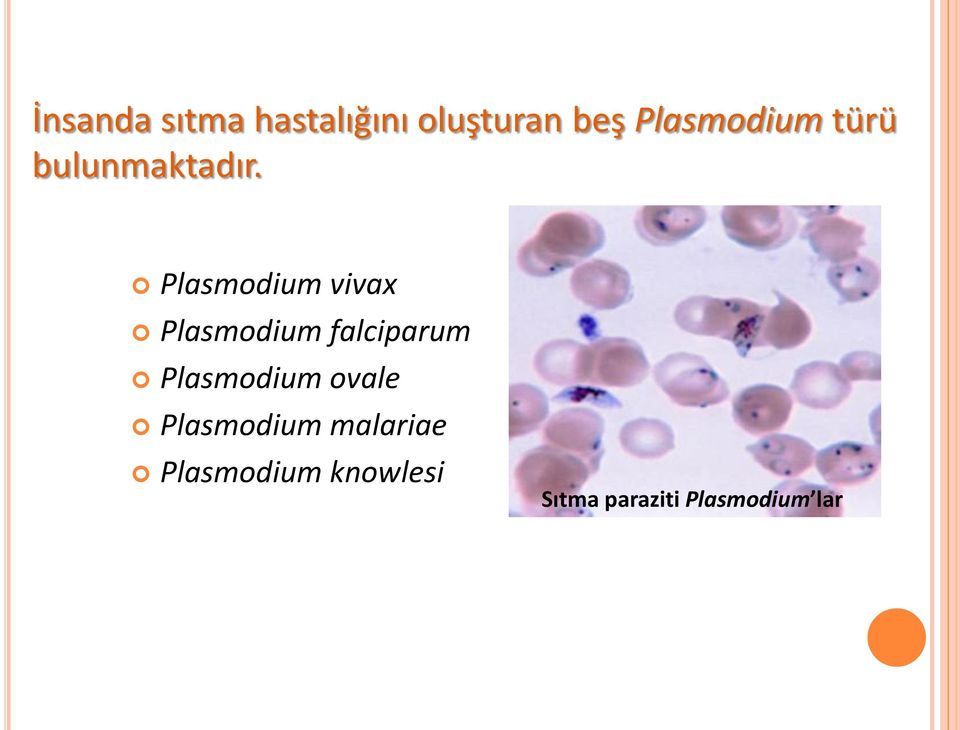 Plasmodium vivax Plasmodium falciparum