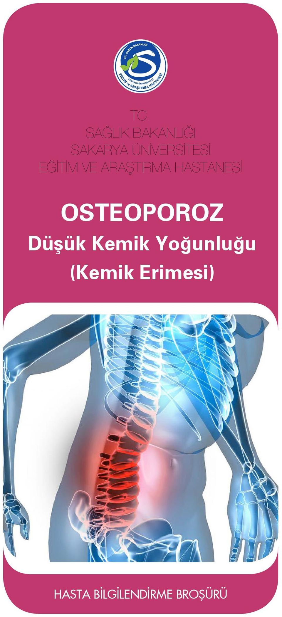 HASTANESİ OSTEOPOROZ Düşük Kemik